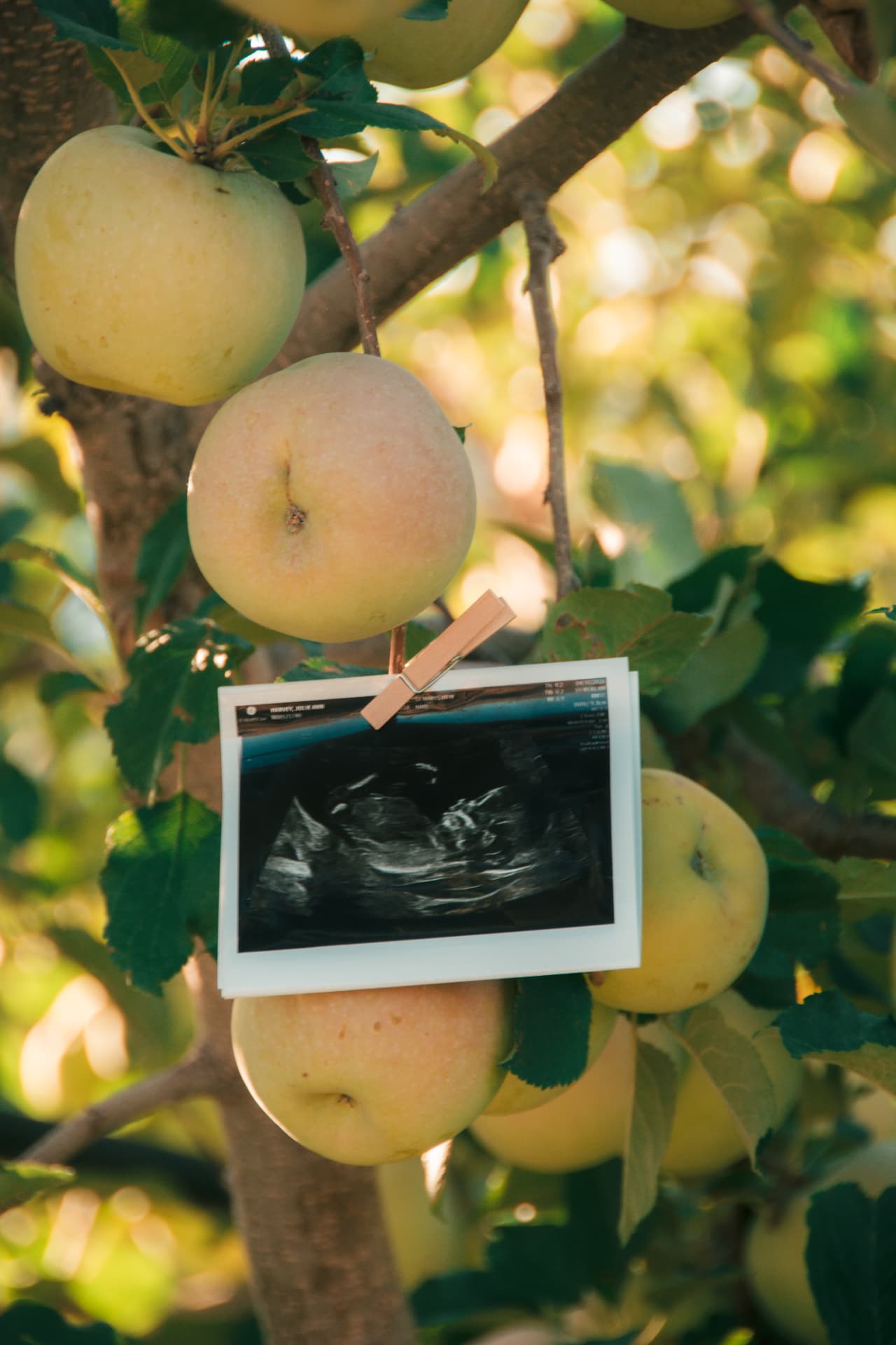 Ultrasound photo clipped with a clothespin to an apple branch heavy with fruit